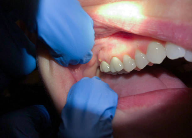 Best Orthodontic Emergency Dentist in Clayton, IN
